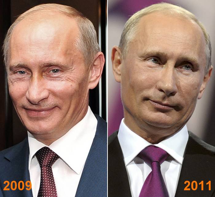 Отдых от президентства и немного ботокса?