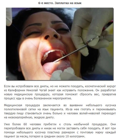 Экстремальные способы сбросить лишний вес (8 фото + текст)