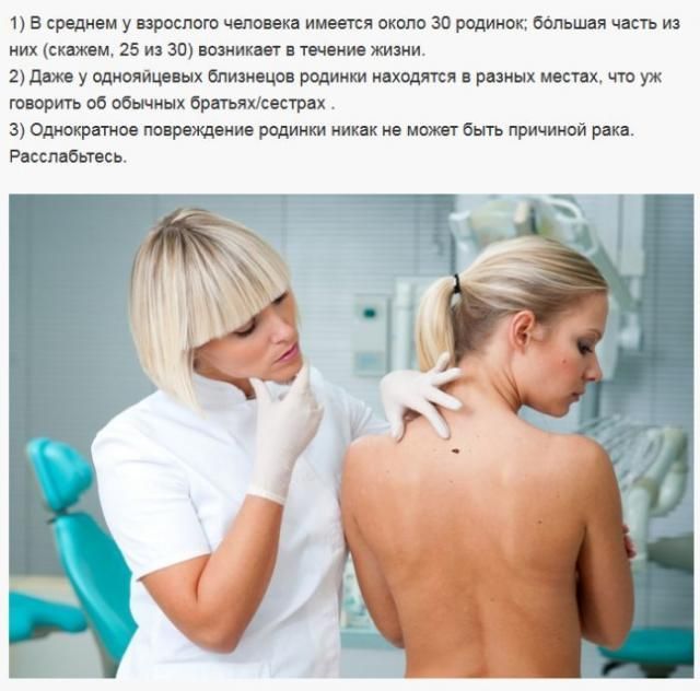 Мифы о родинках
