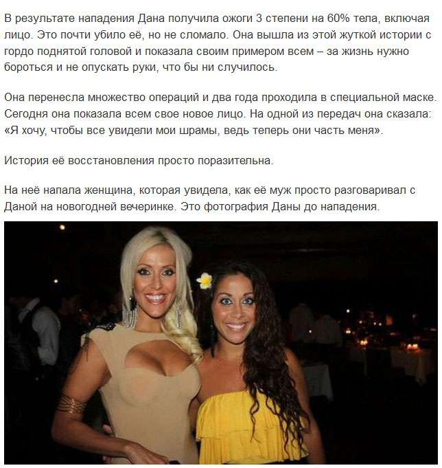 Новое лицо австралийки, которую изуродовала завистница