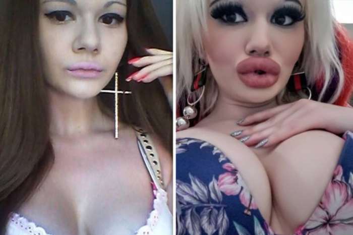 Студентка до и после 15 пластических операций