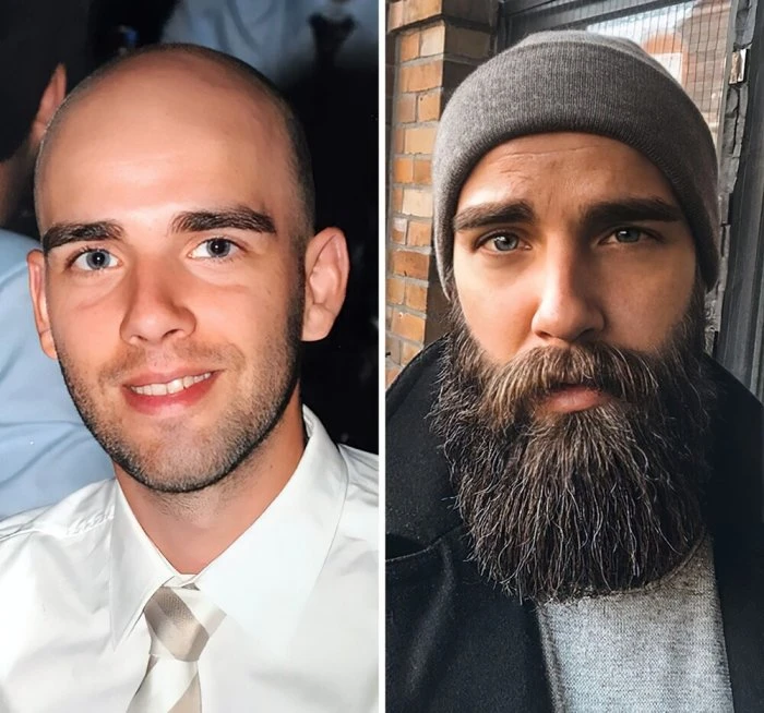 Изменение образа: 23 фото людей, отрастивших себе бороду